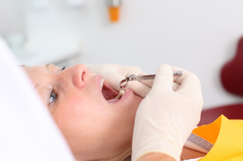 Steps to Take When You Have a Loose Permanent Tooth in Chicago, Illinois