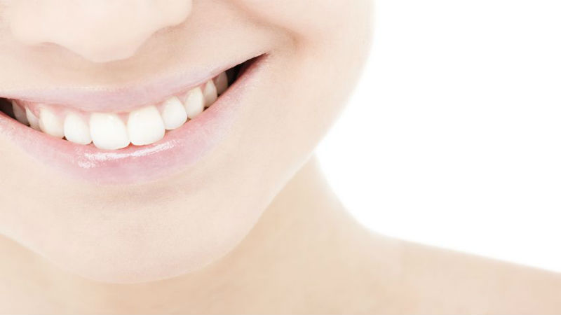 Three Benefits of Professional Teeth Whitening in Kelowna, BC